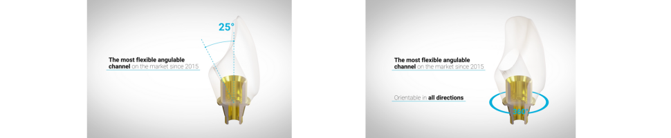 anglebase interfase angulada