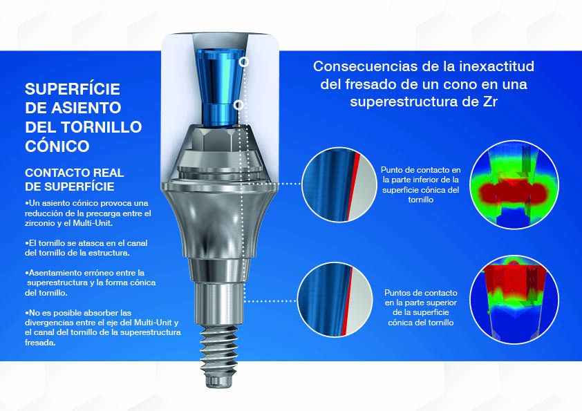 asiento-tornillo-conico