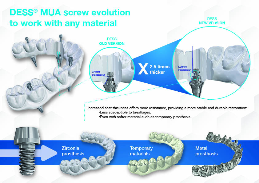 new mua screw angulation
