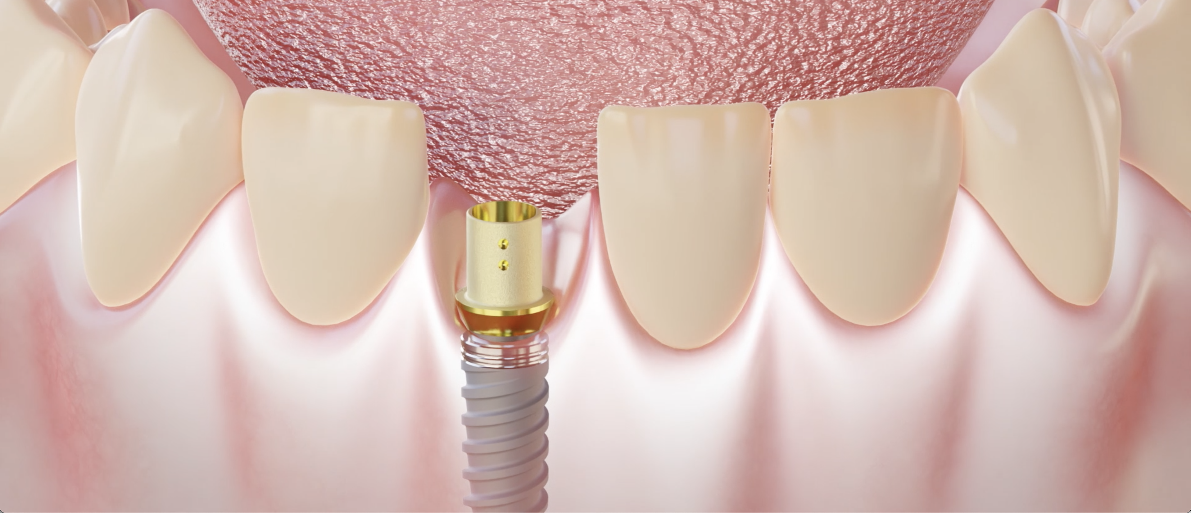 ELLIPTIBase in mouth