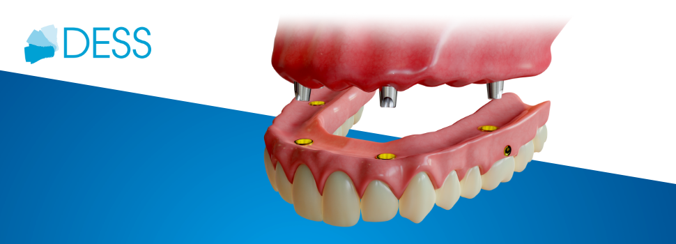 Vorteile von herausnehmbaren Deckprothesen: Einblicke in klinische Fälle & Vorteile für Patienten